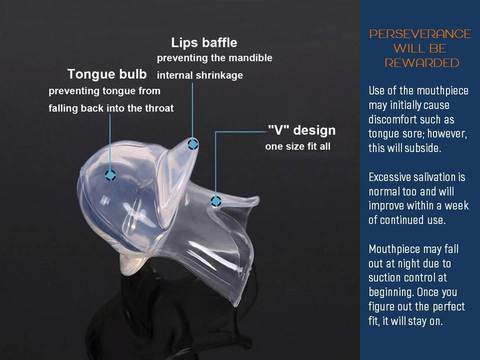 Apnea Tongue Stabilizing Device