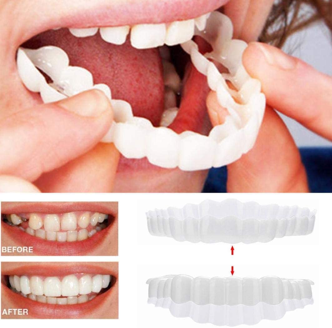 Smile Veneer (Upper & Lower Included)